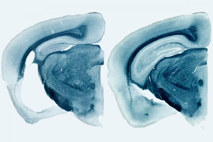 ApoE Tau Brains