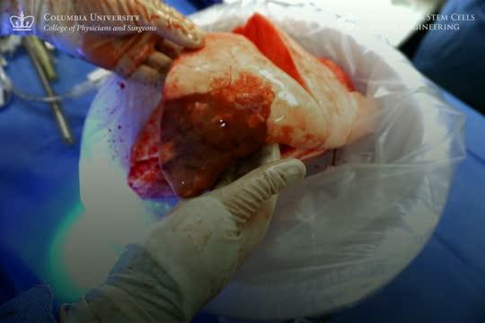 Video: New Approach Shows Regeneration of Severely Damaged Lungs