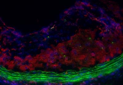Atherosclerotic Plaque: Macrophages on the Move