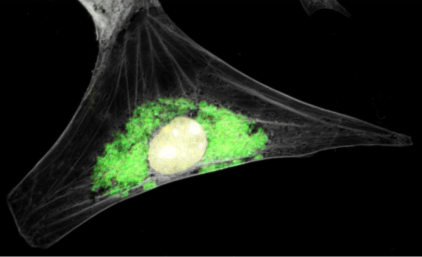Guinea Pig Cell Infected with Chlamydia caviae