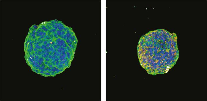 An anti-KRAS ASO inhibits pancreatic tumor growth