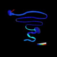 Esophagus