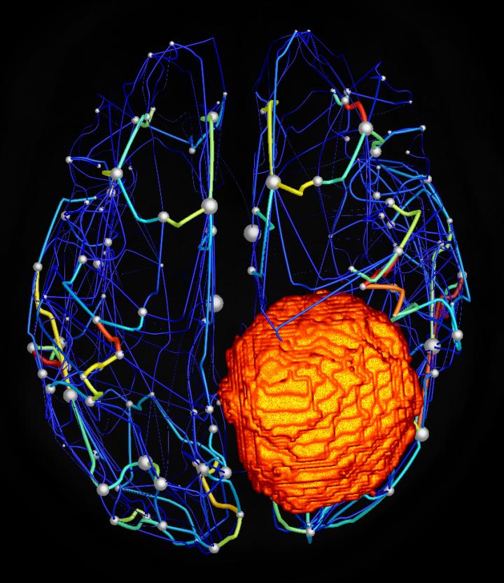 Structural Brain Network