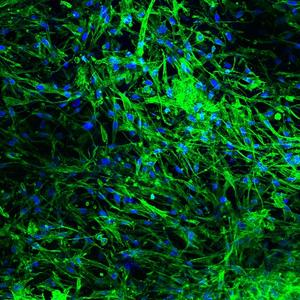 Fluorescent staining of skin cells taken from the patient and grown on the bioengineered graft.