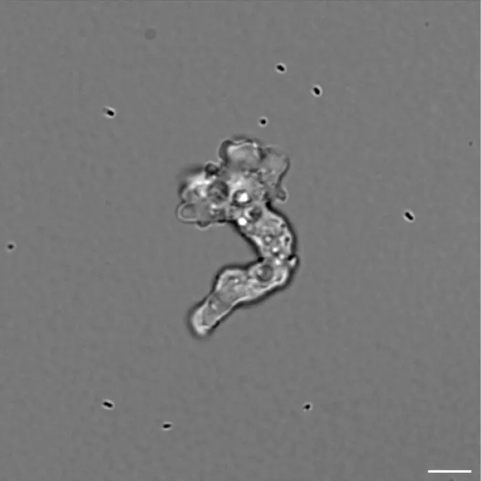 Amoeba at 55ºC