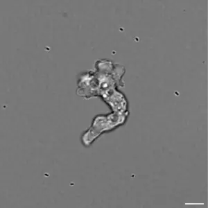 Amoeba at 55ºC