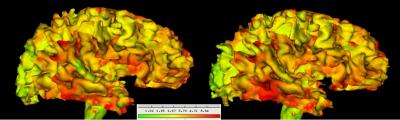 Brain Maturation Measured by Cortical Thickness