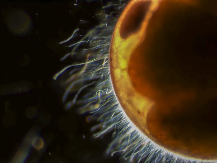 Bacteria on Lobster Egg