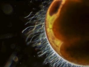 Bacteria on Lobster Egg