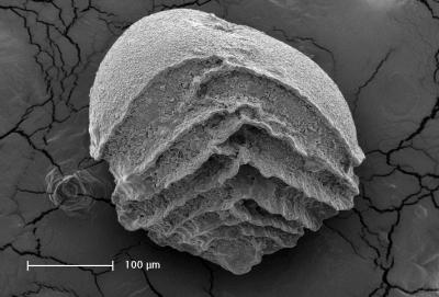 Benthic Foram