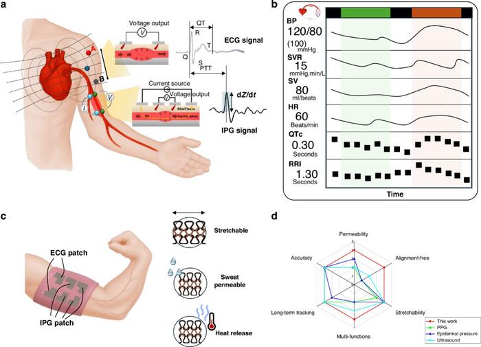 Working principle of textile-based cardiovascular heamodynamic measurement.