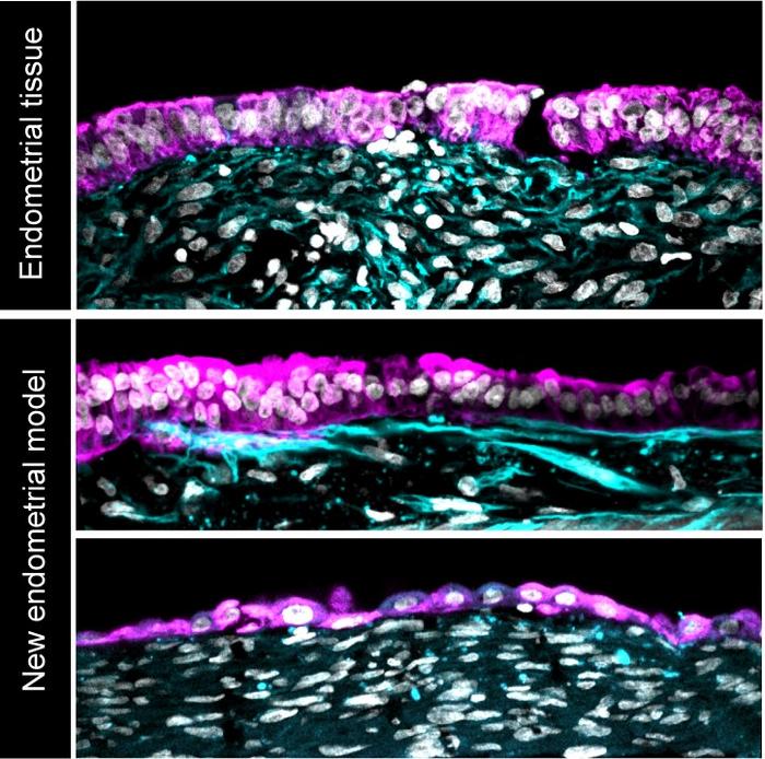 Comparison between model and biopsy