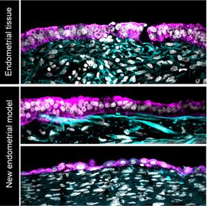Comparison between model and biopsy