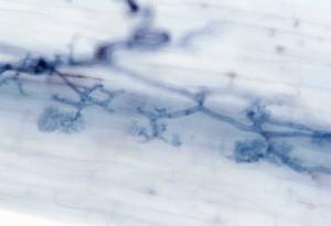 A beneficial arbuscular mycorrhiza fungus colonising a barley root.