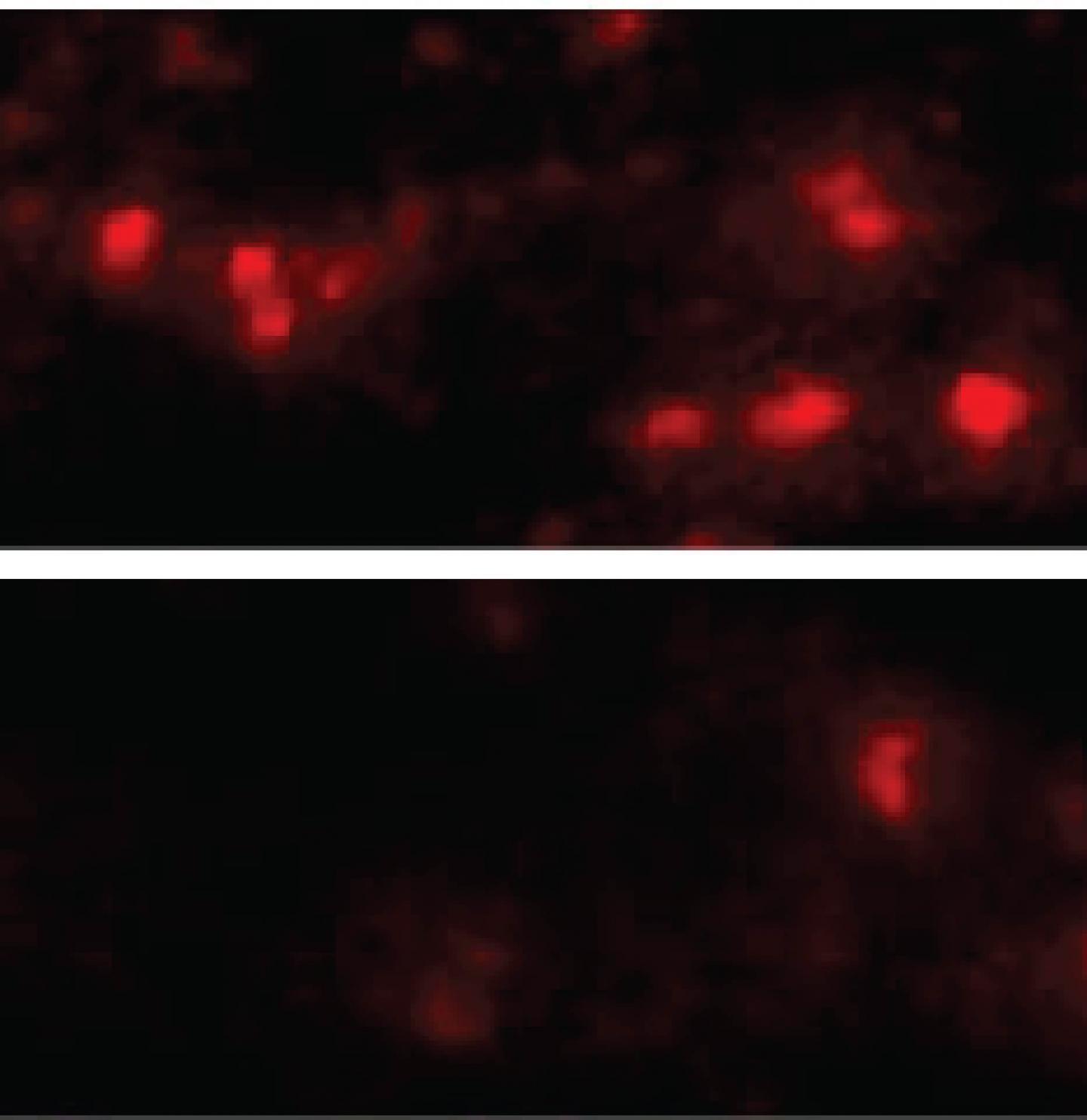 &alpha;-synuclein