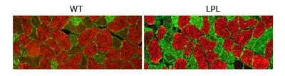 LPL Overexpression Reconfigures Muscle