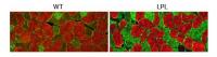 LPL Overexpression Reconfigures Muscle