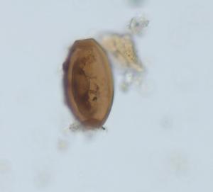 Trichuris (whipworm) egg from pig dental calculus.