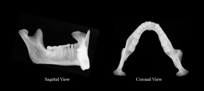Jaw