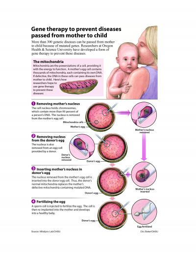 Illustration of Procedure