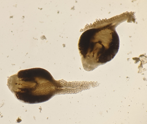 Parasitic worms