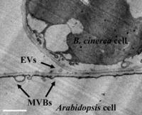 Extracellular Vesicles