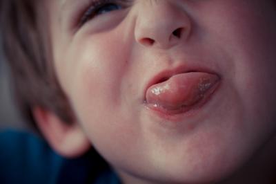Tongue
