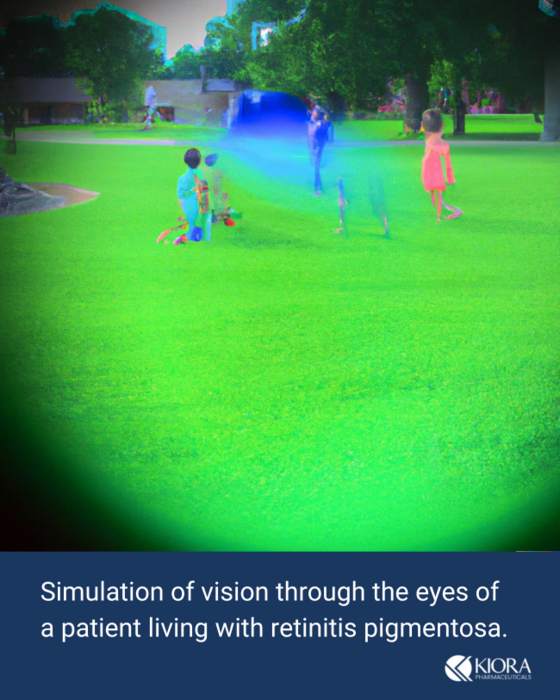 RP Vision