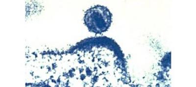 HIV Budding