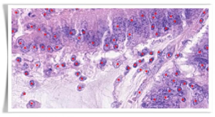 Cancer Cells