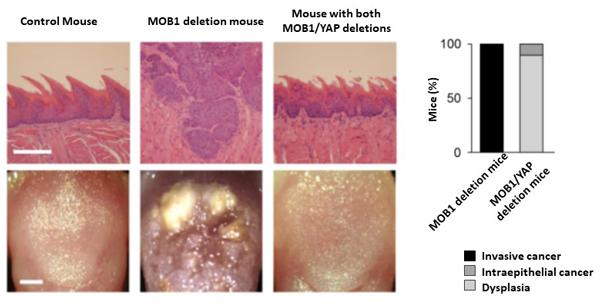 図2．MOB1欠損による舌癌形成のYAP依存性
