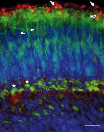 Cofilin Links Reelin Signaling to Cytoskeletal Dynamics