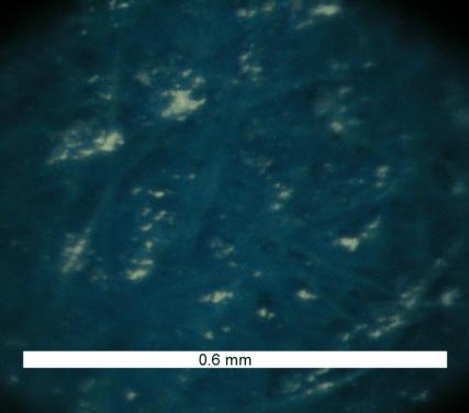 Laser Ablation