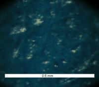 Laser Ablation