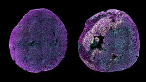 A New RNA Therapy Could Help the Heart Repair Itself