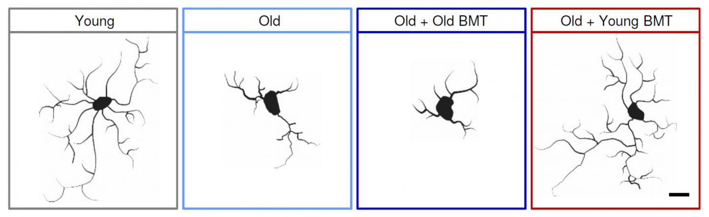 Young Bone Marrow Rejuvenates Aging Mouse Brains