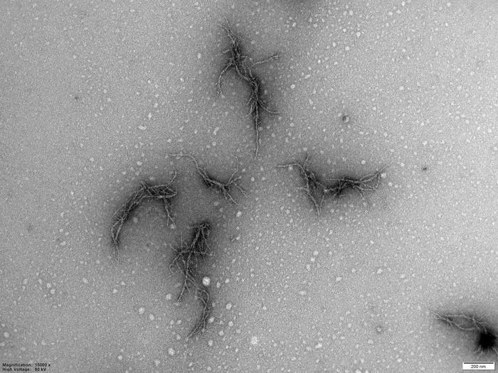 Amyloid from the SARS-CoV-2 virus’ spike protein
