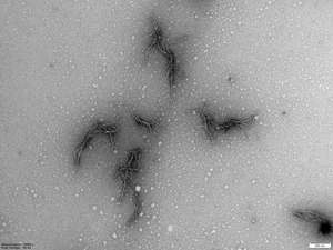 Amyloid from the SARS-CoV-2 virus’ spike protein