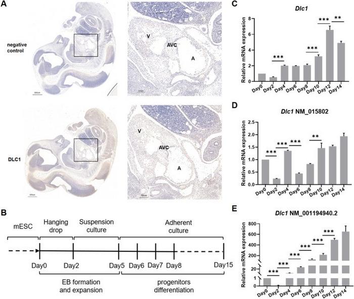 Dynamic Dlc1 expression changes during cardiac progenitor differentiation of mESCs.