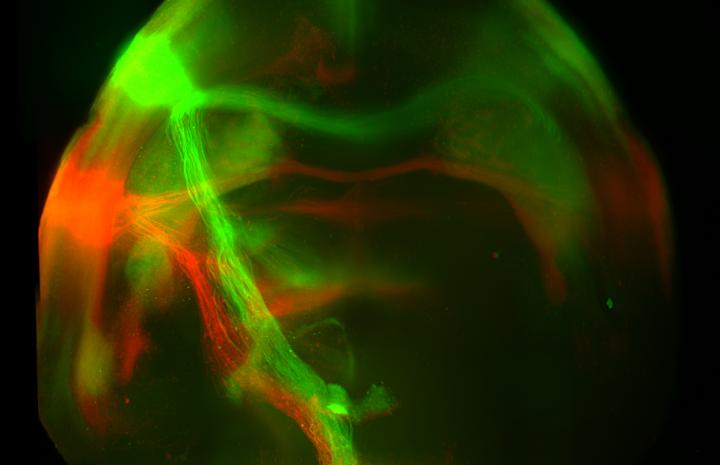 Projections from Sweet and Bitter Cortex to Amygdala