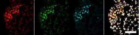 Clusters of Human Embryonic Stem Cells