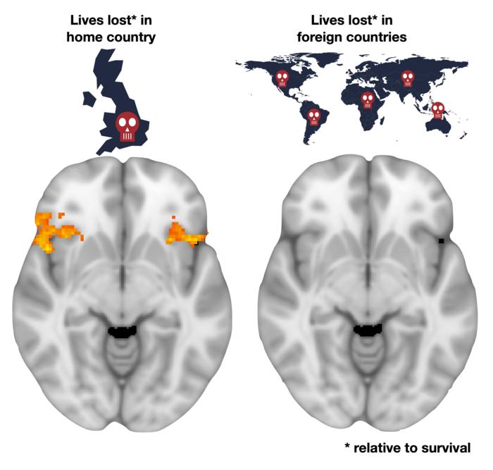 Brain scan showing activated regions.