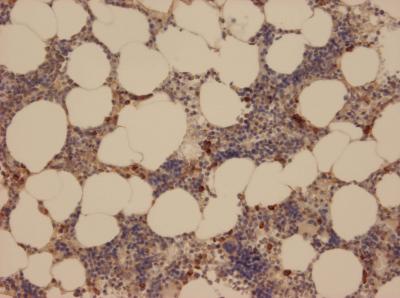 Neutrophil