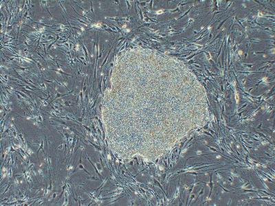 Human Induced Pluripotent Stem Cell