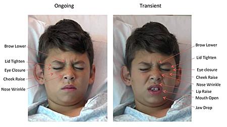 Pediatric Pain Assessment
