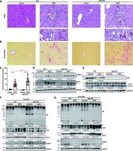 Hepatic p62 is dispensable for DDC-diet induced cholestatic injury, fibrosis and hepatocytic MDB formation.