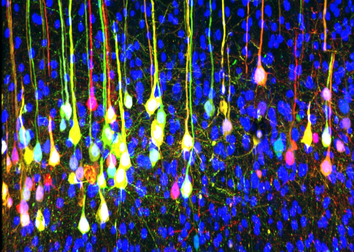 Neuron Tracing