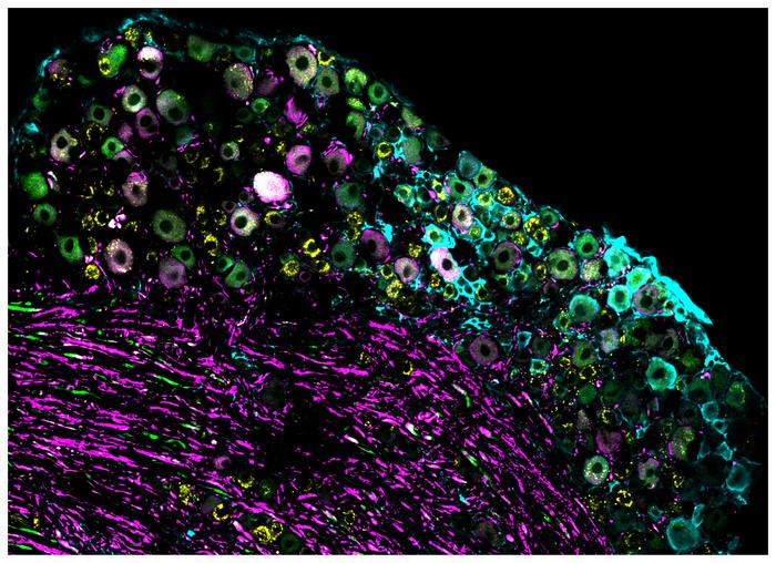 Cluster of nerve cells