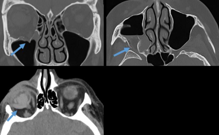 Radiology Images