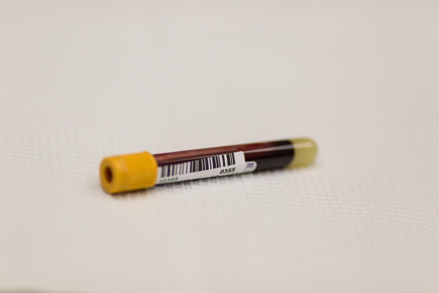 Study Participants Tested Positive for West Nile Virus, not Zika